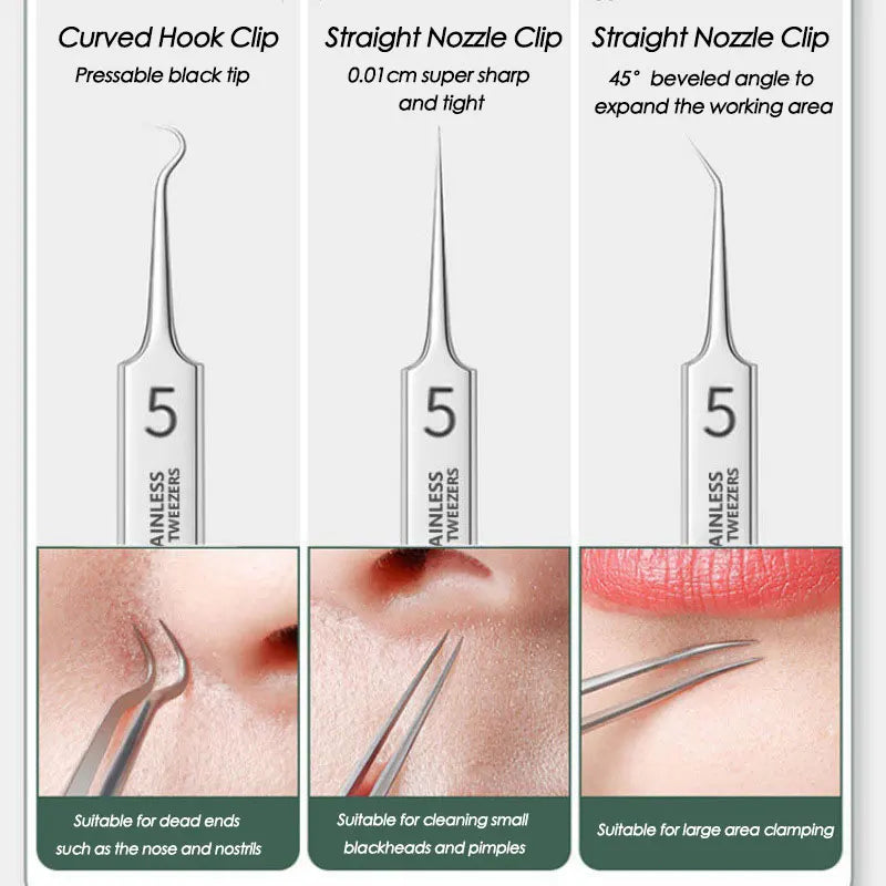 Stainless Steel Blackhead/Blemish Remover Kit